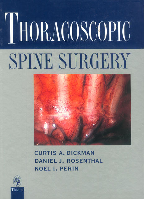 Thoracoscopic Spine Surgery, Daniel Rosenthal, Curtis A.Dickman, Noel I.Perin