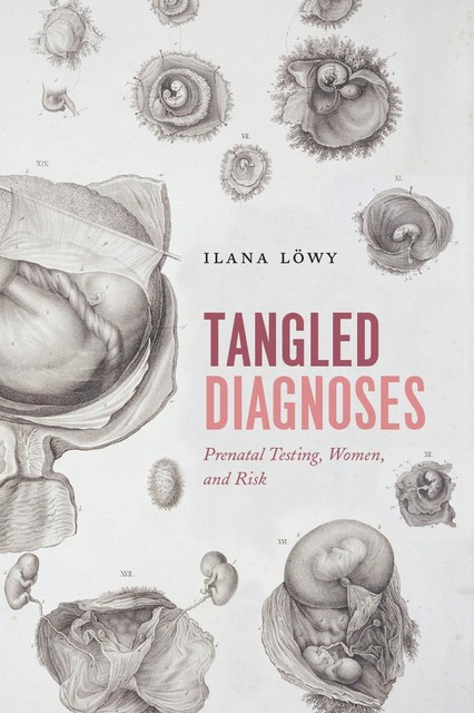 Tangled Diagnoses: Prenatal Testing, Women, and Risk, Ilana Löwy