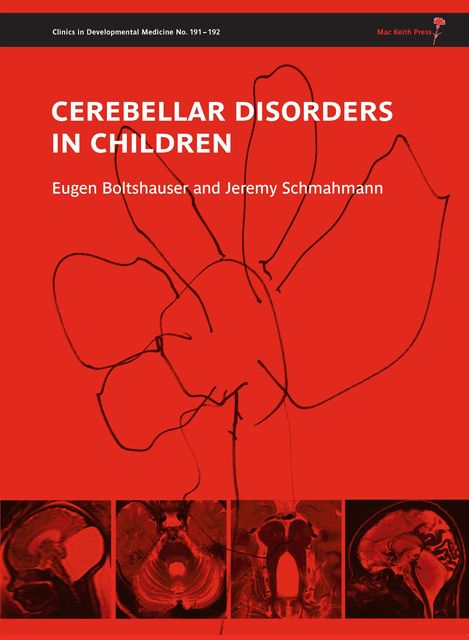 Cerebellar Disorders in Children, Eugen Boltshauser, Jeremy Schmahmann