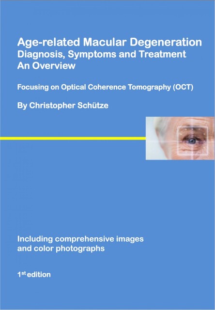 Age-related macular degeneration, Christopher Schütze