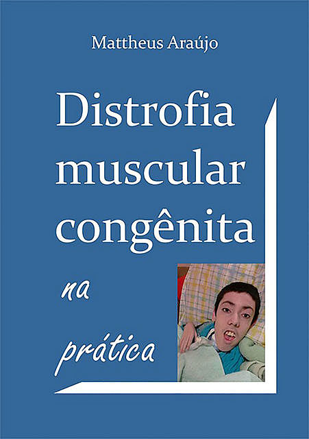 Distrofia Muscular Congênita Na Prática, Mattheus Araújo
