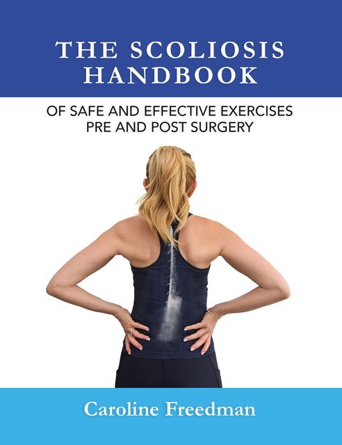 The Scoliosis Handbook of Safe and Effective Exercises Pre and Post Surgery, Caroline Freedman