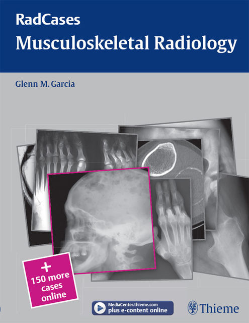 Musculoskeletal Radiology, Glenn M.Garcia