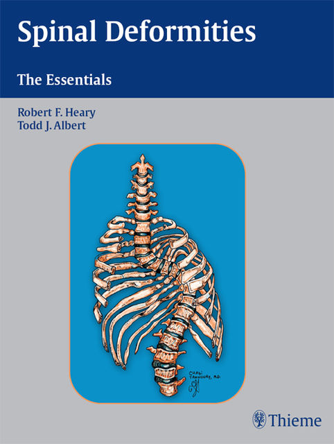 Spinal Deformities, Todd J.Albert, Robert F.Heary