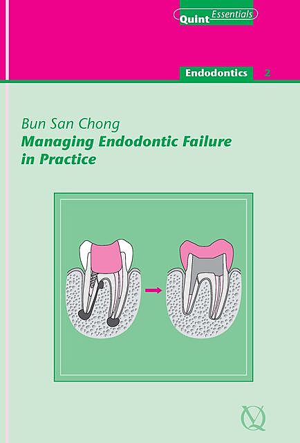 Managing Endodontic Failure in Practice, Bun San Chong