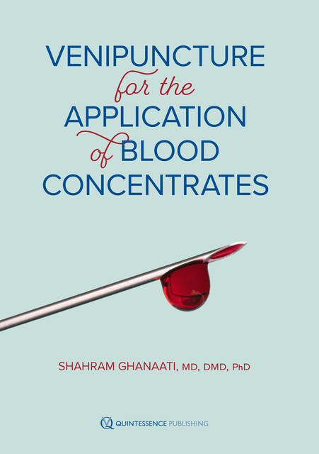 Venipuncture for the Application of Blood Concentrates, Shahram Ghanaati