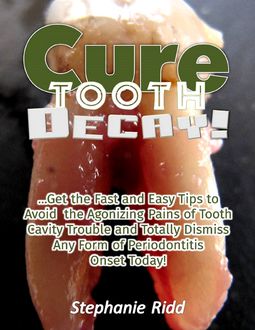 Cure Tooth Decay! : Get the Fast and Easy Tips to Avoid the Agonizing Pains of Tooth Cavity Trouble and Totally Dismiss Any Form of Periodontitis Onset Today, Stephanie Ridd