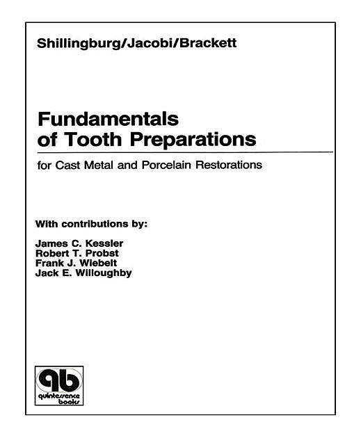 Fundamentals of Tooth Preparations for Cast Metal and Porcelain Restorations, Herbert T Shillingburg, Richard Jacobi, Susan E. Brackett