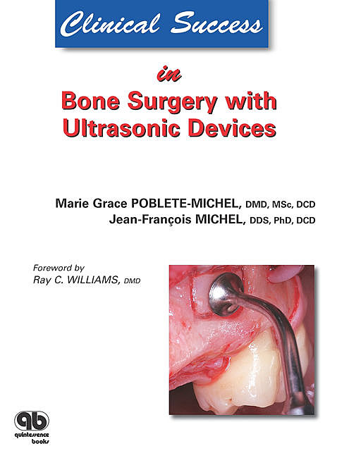 Clinical Success in Bone Surgery with Ultrasonic Devices, Jean-Franҫois Michel, Marie G. Poblete-Michel
