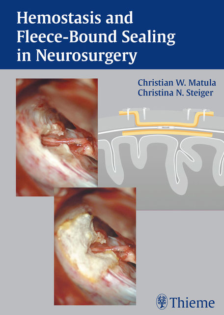 Hemostasis and Fleece-Bound Sealing in Neurosurgery, Christian Matula, Christina N.Steiger