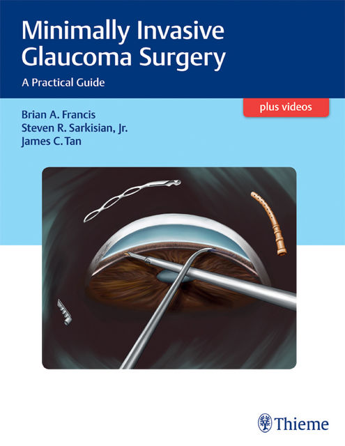 Minimally Invasive Glaucoma Surgery, Brian Francis, James C. Tan, Steven Sarkisian