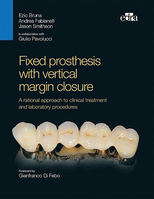 Fixed prosthesis with vertical margin closure, Andrea Fabianelli, Ezio Bruna, Jason Smithson