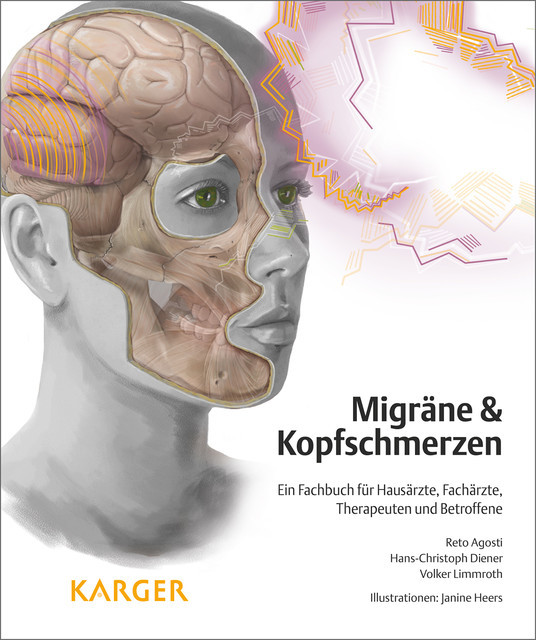 Migräne und Kopfschmerzen, Reto Agosti