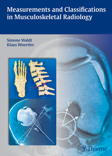 Measurements and Classifications in Musculoskeletal Radiology, Klaus Woertler, Matthias Eiber, Simone Waldt