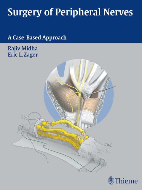Surgery of Peripheral Nerves, Eric L.Zager, Rajiv Midha