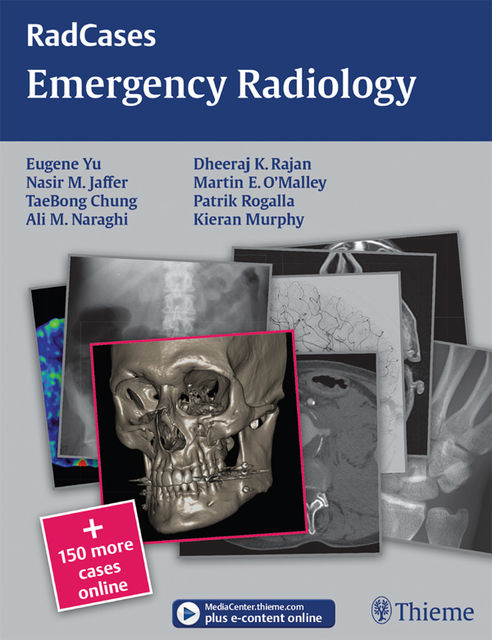 Emergency Radiology, Eugene Yu, Nasir Jaffer, TaeBong Chung