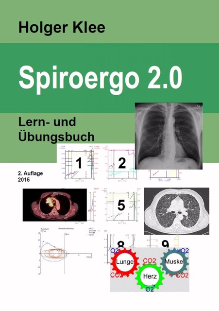 Spiroergo 2.0, Holger Klee