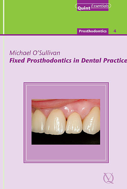 Fixed Prosthodontics in Dental Practice, Michael O'Sullivan
