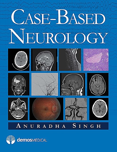 Case-Based Neurology, Anuradha Singh