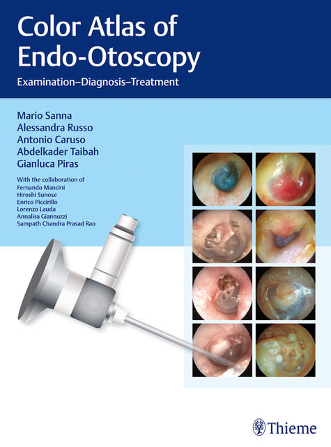 Color Atlas of Endo-Otoscopy, Mario Sanna, Alessandra Russo, Antonio Caruso