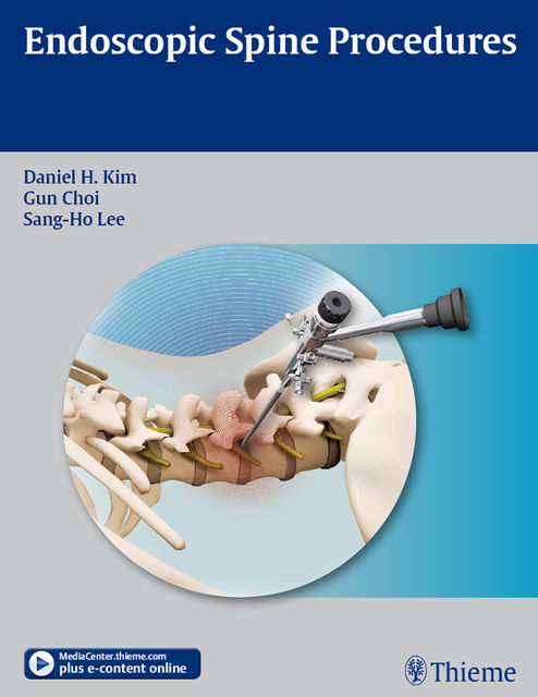 Endoscopic Spine Procedures, Daniel H.Kim, Gun Choi, Sang-Ho Lee