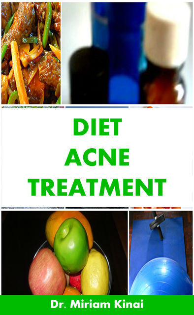 Diet Acne Treatment, Miriam Kinai