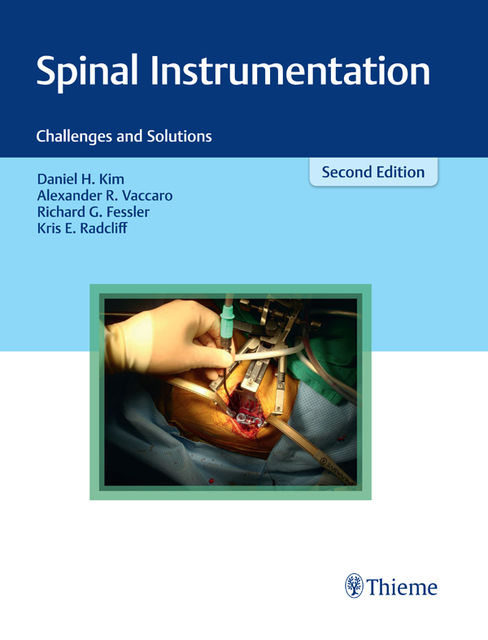 Spinal Instrumentation, Alexander R.Vaccaro, Daniel H.Kim, Richard G.Fessler, Kris E. Radcliff