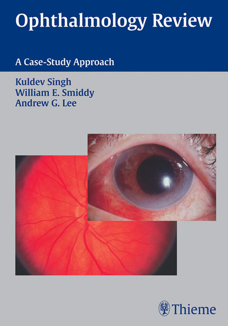 Ophthalmology Review: A Case Study Approach, Andrew Lee, Kuldev Singh, William E.Smiddy
