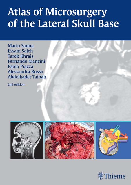 Atlas of Microsurgery of the Lateral Skull Base, Mario Sanna, Essam A.Saleh