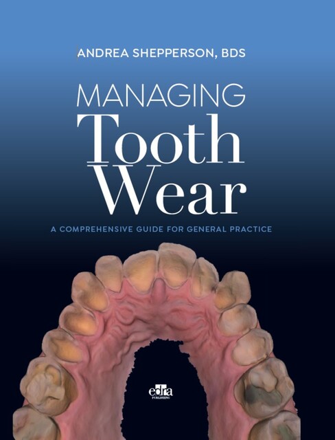 Managing Tooth Wear, Andrea Shepperson