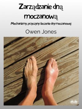 Zarządzanie Dną Moczanową-Mechanizmy, Przyczyny I Leczenie Dny Moczanowej, Owen Jones