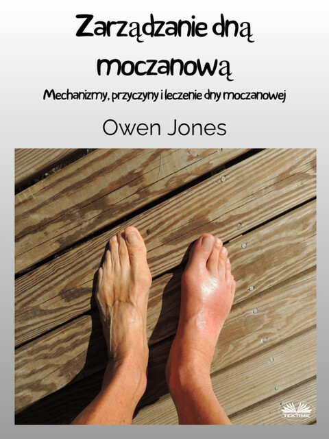 Zarządzanie Dną Moczanową-Mechanizmy, Przyczyny I Leczenie Dny Moczanowej, Owen Jones