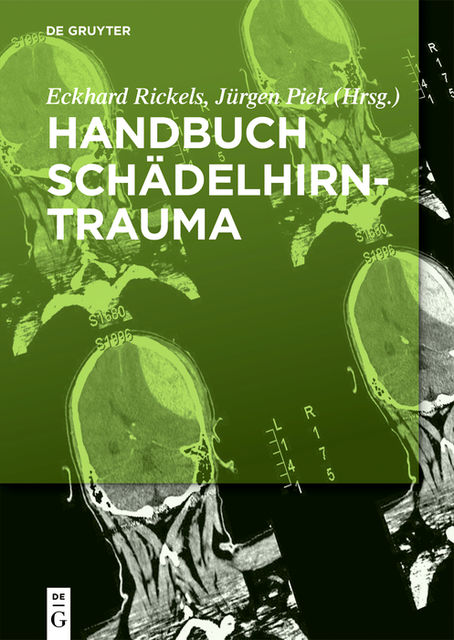 Handbuch Schädel-Hirn-Trauma, Eckhard Rickels, Jürgen Piek