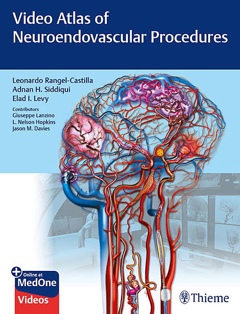 Video Atlas of Neuroendovascular Procedures, Leonardo Rangel-Castilla, Adnan H. Siddiqui, Elad I. Levy
