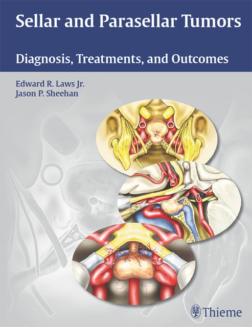Sellar and Parasellar Tumors, Edward R.Laws, Jason Sheehan