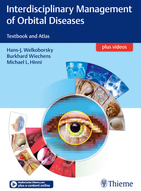 Interdisciplinary Management of Orbital Diseases, Burkhard Wiechens, Hans-J. Welkoborsky, Michael L. Hinni