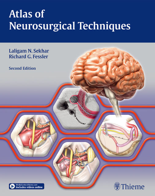 Atlas of Neurosurgical Techniques, Richard G.Fessler, Laligam Sekhar