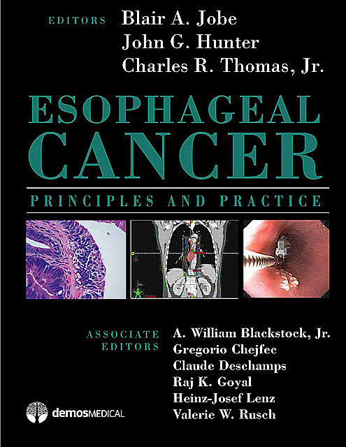 Esophageal Cancer, John Hunter, Thomas Charles, Blair A. A Jobe
