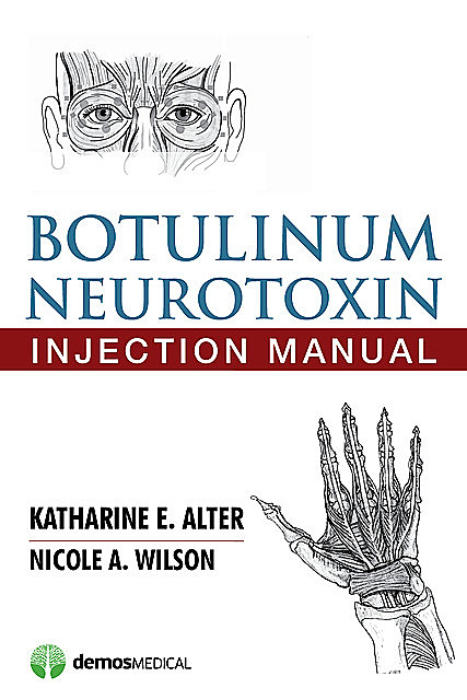 Botulinum Neurotoxin Injection Manual, Nicole Wilson, Katharine E. Alter
