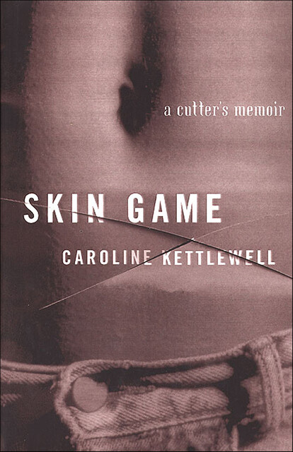 Skin Game, Caroline Kettlewell