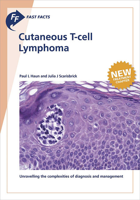 Fast Facts: Cutaneous T-cell Lymphoma, J.J. Scarisbrick, P.L. Haun
