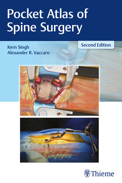Pocket Atlas of Spine Surgery, Alexander R.Vaccaro, Kern Singh