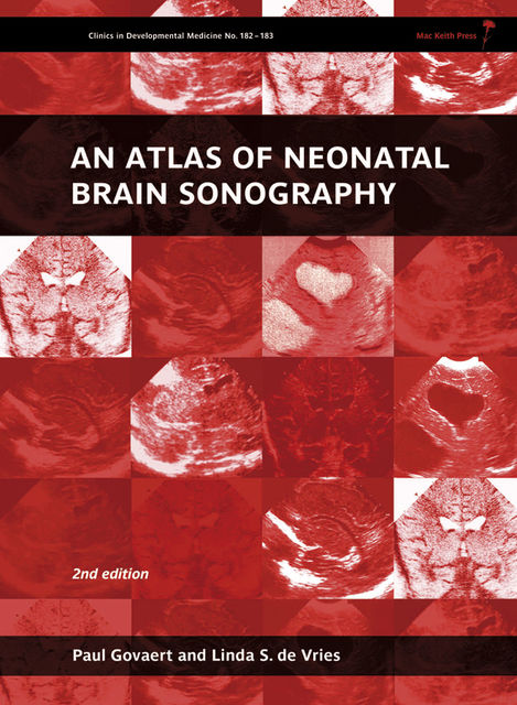 An Atlas of Neonatal Brain Sonography, 2nd Edition, Linda S de Vries, Paul Govaert