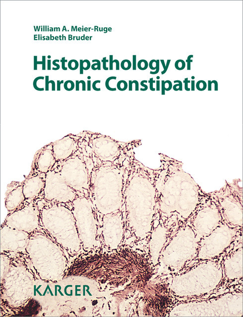 Histopathology of Chronic Constipation, Bruder, W.A. Meier-Ruge