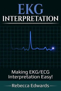 EKG Interpretation, Rebecca Edwards
