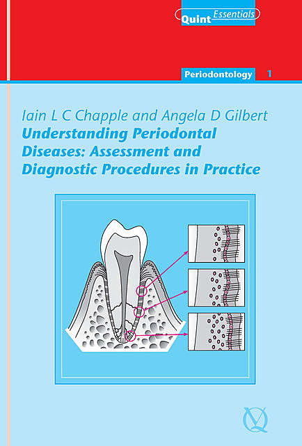 Understanding Periodontal Diseases: Assessment and Diagnostic Procedures in Practice, Iain L.C. Chapple, Angela Gilbert