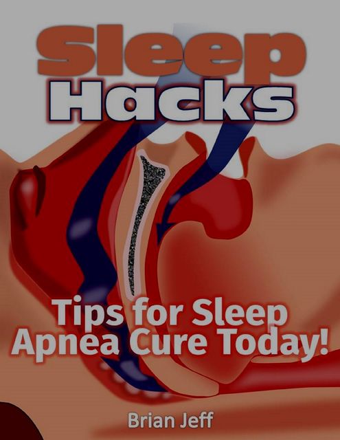 Sleep Hacks: Tips for Apnea Cure Today!, Brian Jeff