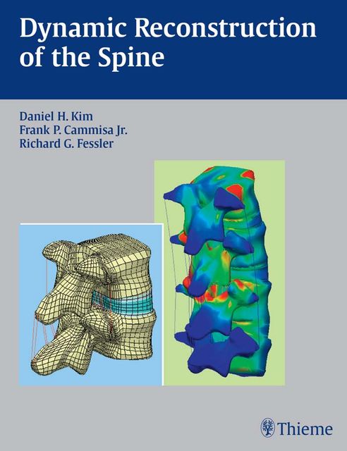 Dynamic Reconstruction of the Spine, Daniel H.Kim, Richard G.Fessler, Frank P.Cammisa Jr.