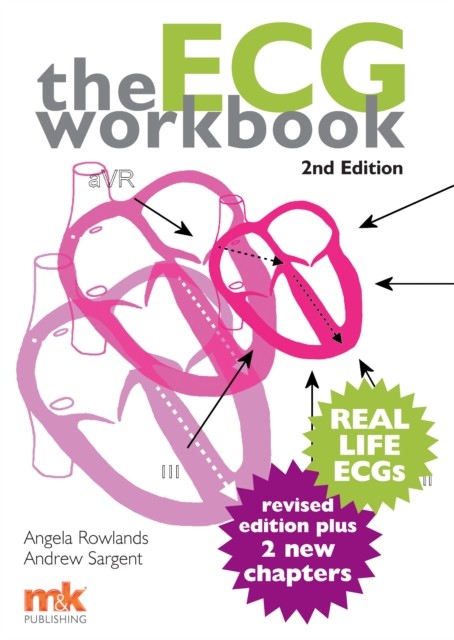 ECG Workbook, Angela Rowlands