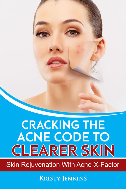 Cracking the Acne Code to Clearer Skin, Kristy Jenkins